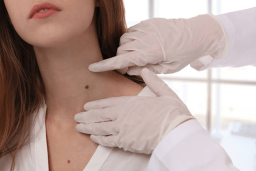 Benefits of Professional CO2 Laser