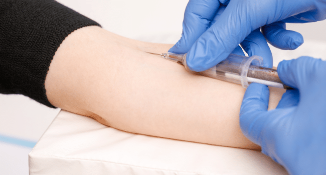 Blood Sample Collection Service