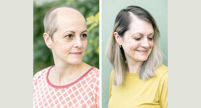 Boosting Your Hair's Volume