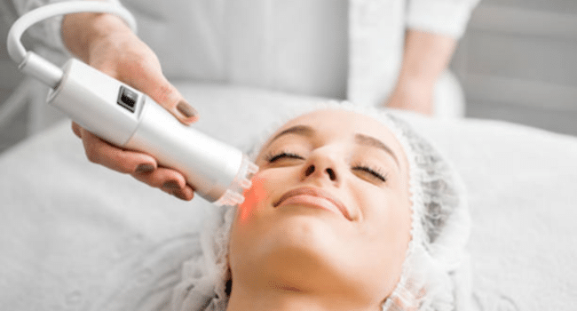 CO2 Laser Treatment
