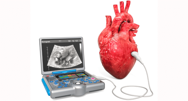 Cardiac Diagnostics