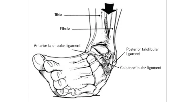 Common Foot and Ankle Injuries