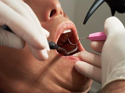 Dental Care and Specialized Treatments