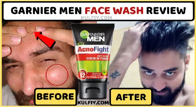 Garnier acno Fight Face Wash