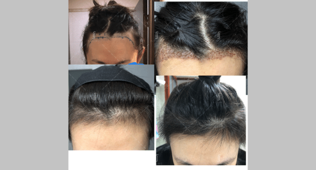 Hair Confidence Revolution