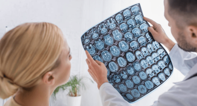 Head MRI