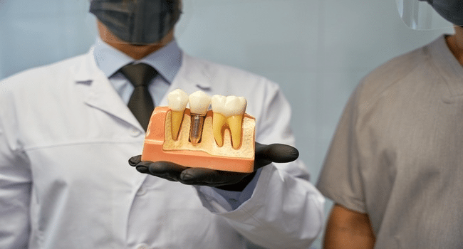 How Long Do Dental Implants Last