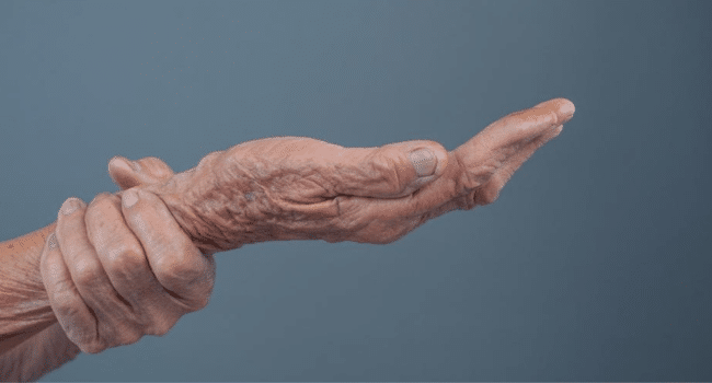 Joint Pain