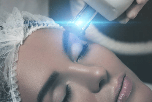 Laser Resurfacing Costs