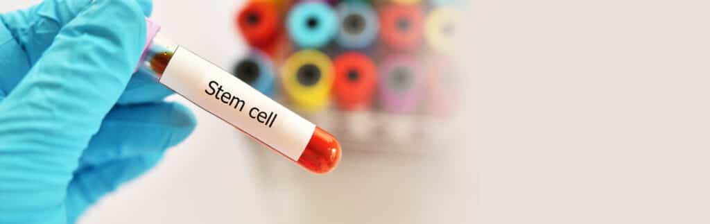 LifeCell’s Stem