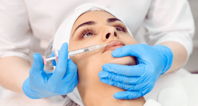 Lip Fillers