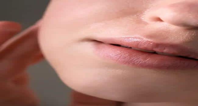 Lip Hydration vs Lip Filler