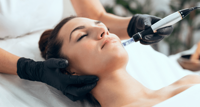 Microneedling