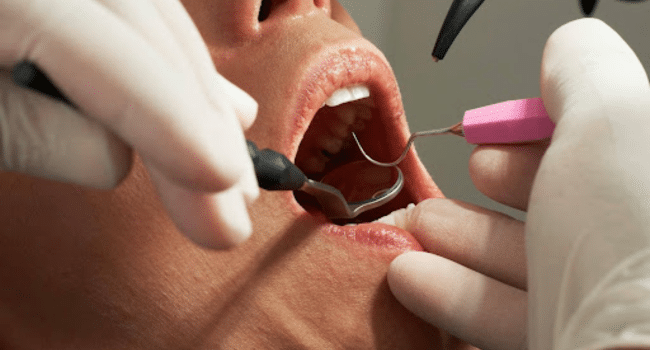 Preventive Dental Care