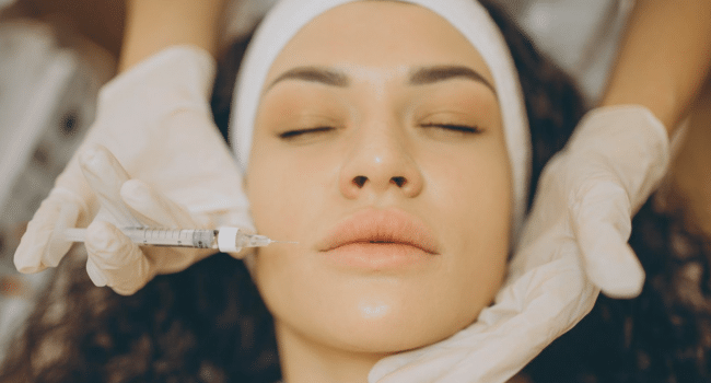 Restylane Filler Injections