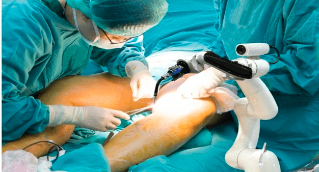 Robotic Knee Replacement Surgery
