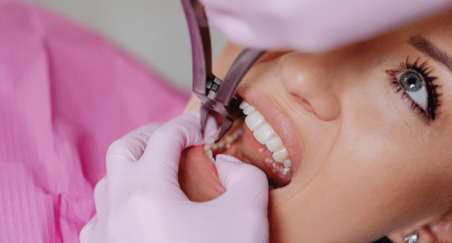 Single Tooth or Full Arch