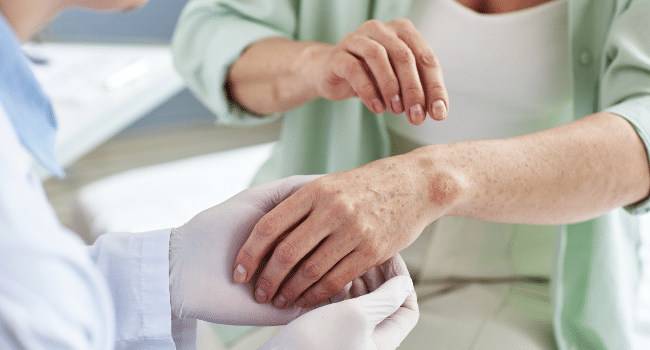 Skin Conditions Online