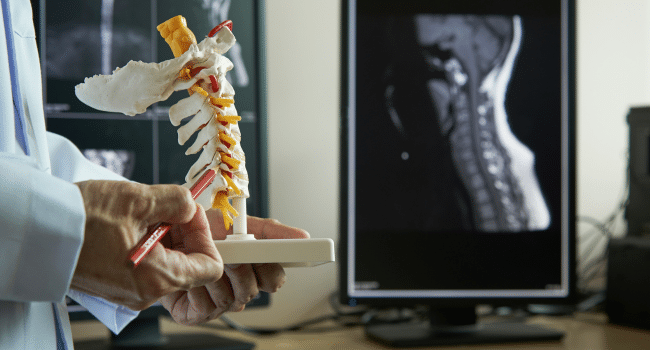 Standardizing Cervical Range