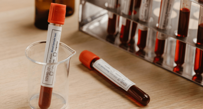 Stem Cell Lymphocytic Leukemia Recovery