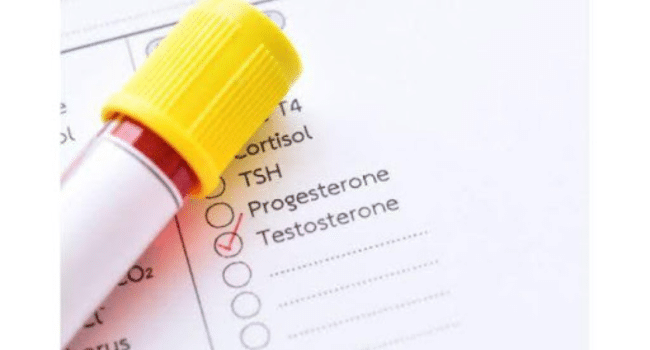Testosterone