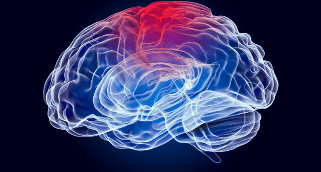 Traumatic Brain Injury Survivor
