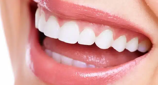 Treat Your Teeth Without Braces