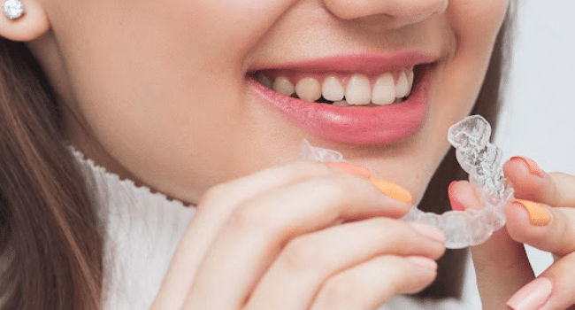 Trendy Invisible Clip For Teeth