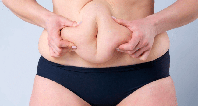 Tummy Tuck Abu Dhabi