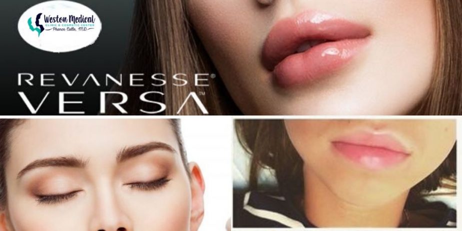 REVANESSE-VERSA-LIPS