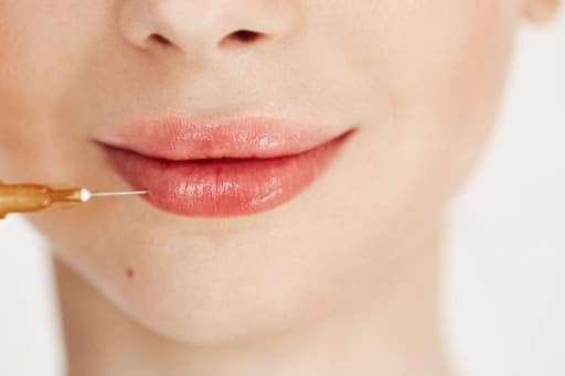 lip-filler-aftercare-long-term